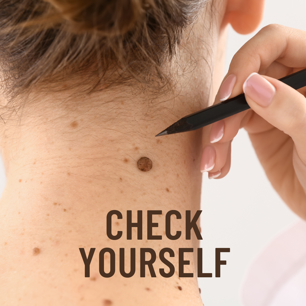 Early Signs of Skin Cancer